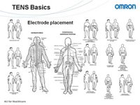 Umístění elektrod - léčba TENS